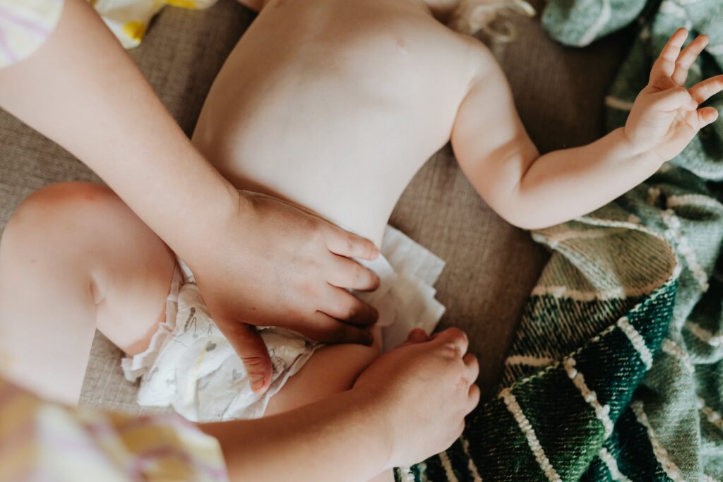 Nappy Rash: What Is It & How To Fix It Nappy Rash: What Is It & How To Fix It